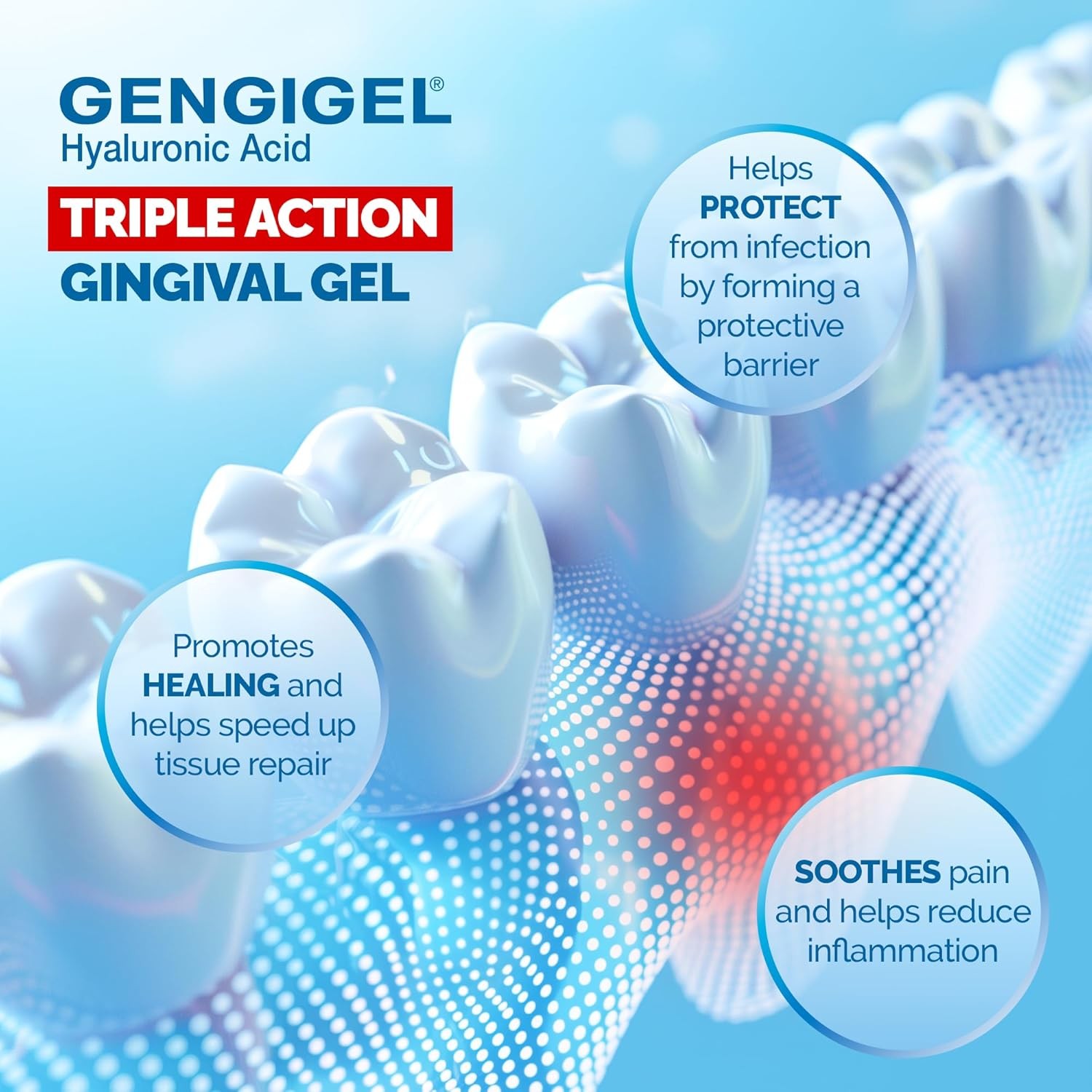 Gengigel Hyaluronic Acid Oral Gel for Mouth & Gum Discomfort (20Ml), Soothes Irr