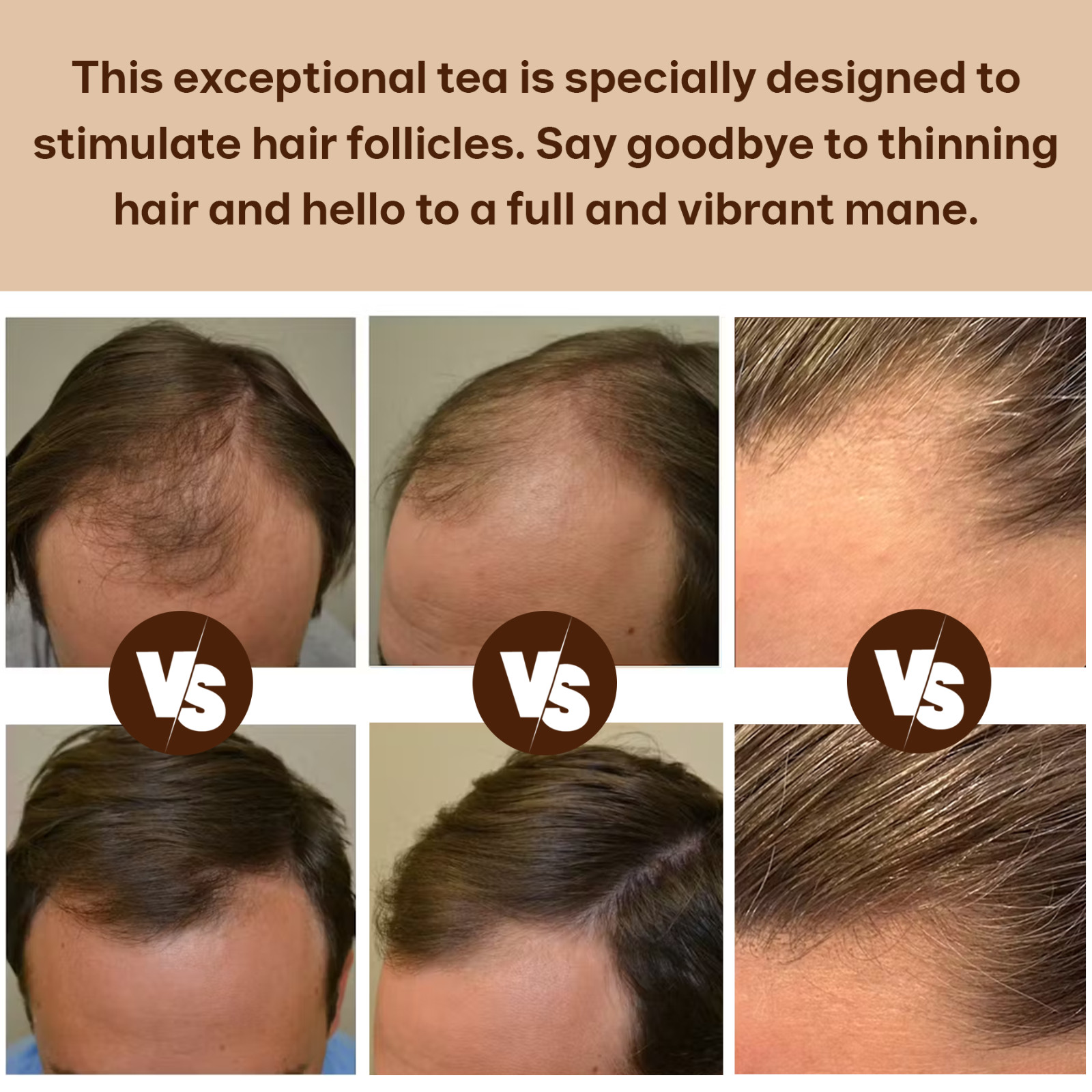 20 Pcs Hair Care Tea For Dark Thick and Lustrous, Hair Loss Natural Solution
