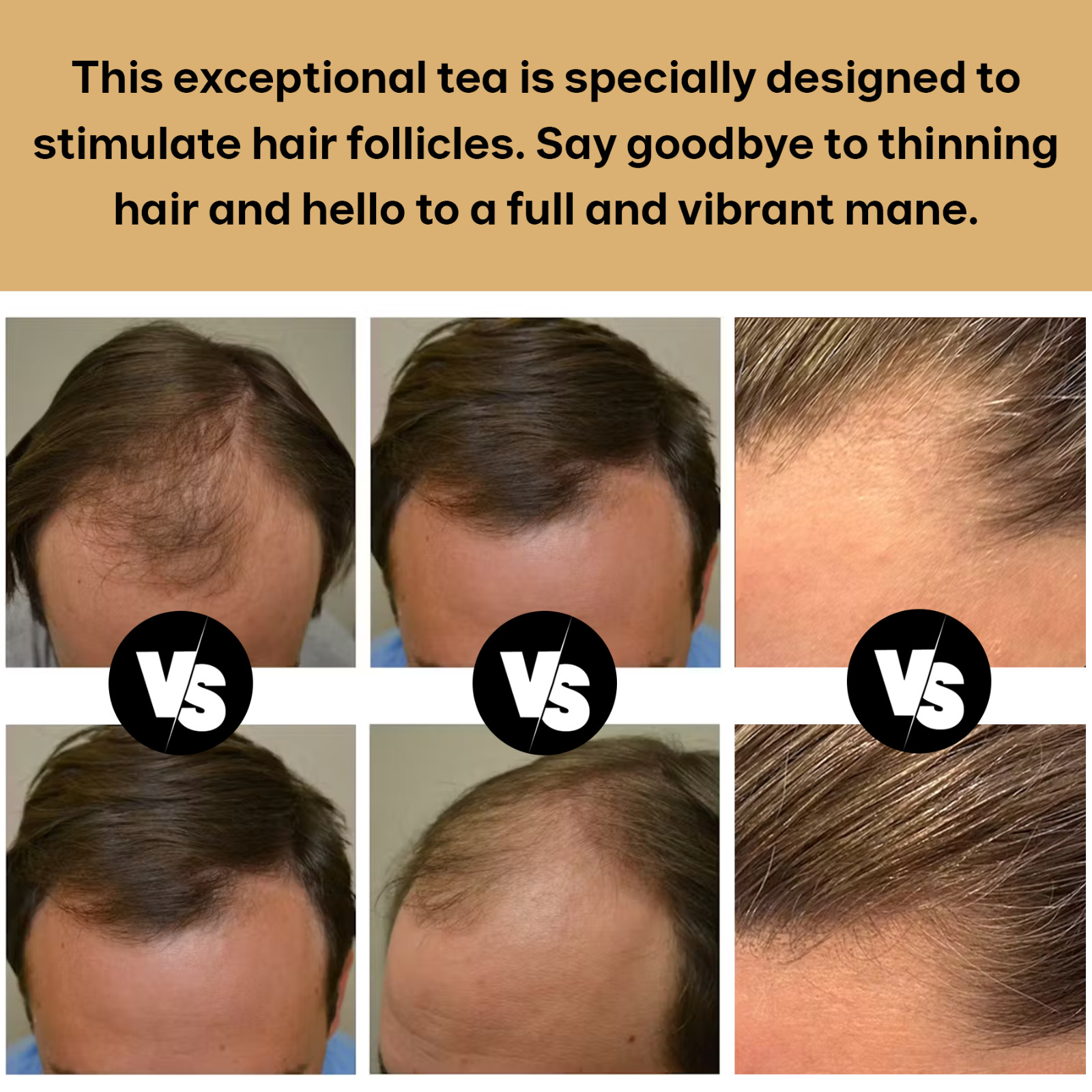 20 Pcs Natural Hair Growth Tea Stimulate Hair Scalp Health Hair Shine and Luster